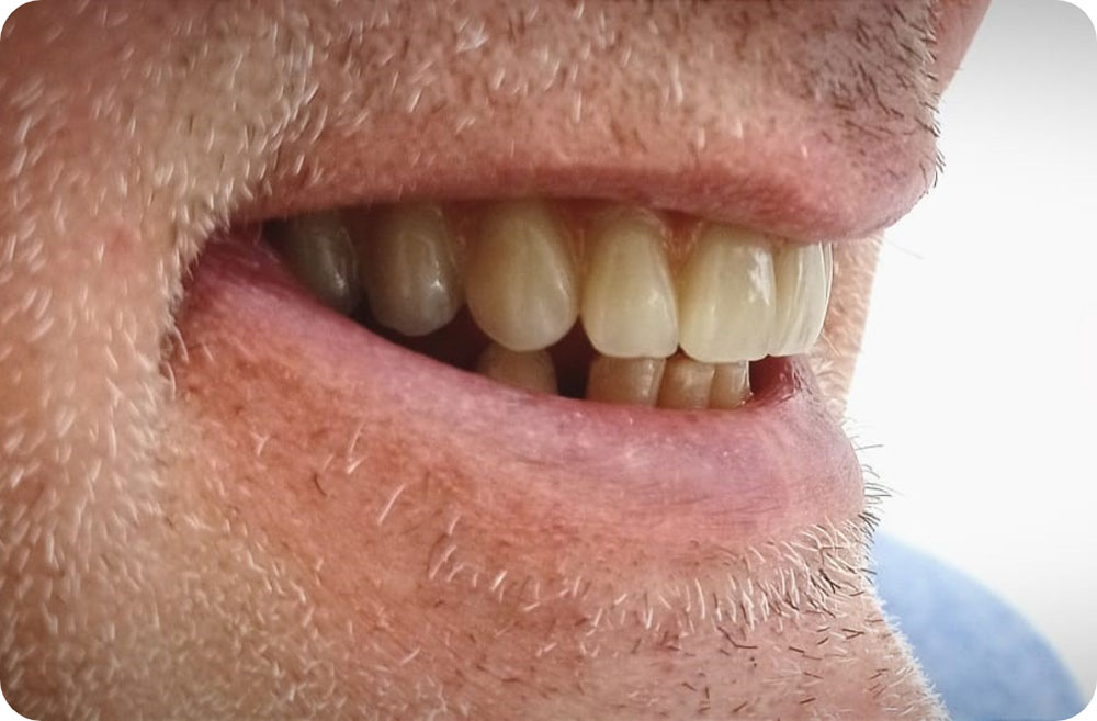 Studio Raschiotti Dentatura