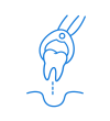 Estrazione dentale presso lo Studio Odontoiatrico Raschiotti